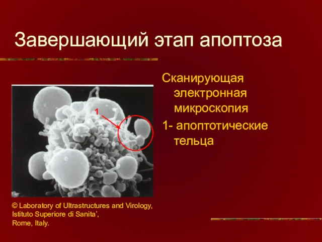 Завершающий этап апоптоза Сканирующая электронная микроскопия 1- апоптотические тельца 1