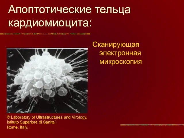 Апоптотические тельца кардиомиоцита: Сканирующая электронная микроскопия © Laboratory of Ultrastructures