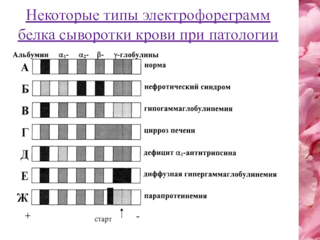 Некоторые типы электрофореграмм белка сыворотки крови при патологии