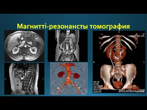 Магнитті-резонансты томография