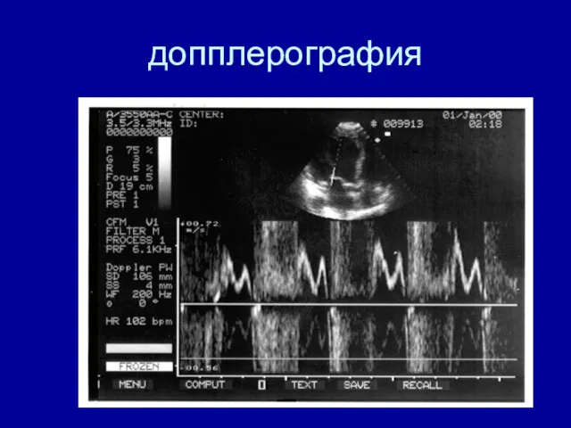 допплерография