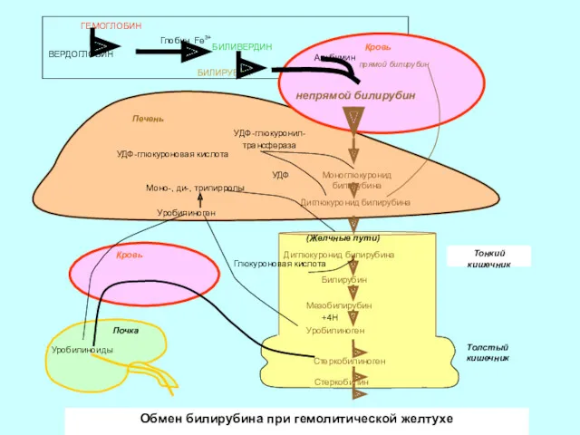 Обмен билирубина при гемолитической желтухе