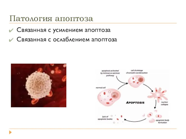 Патология апоптоза Связанная с усилением апоптоза Связанная с ослаблением апоптоза