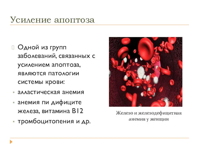 Усиление апоптоза Одной из групп заболеваний, связанных с усилением апоптоза,