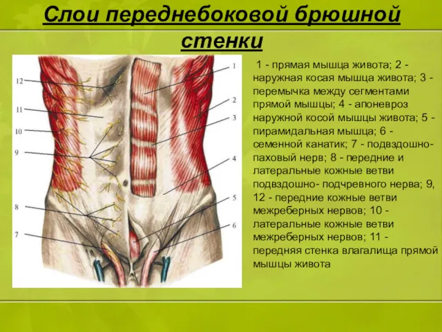 Слои переднебоковой брюшной стенки 1 - прямая мышца живота; 2 - наружная косая