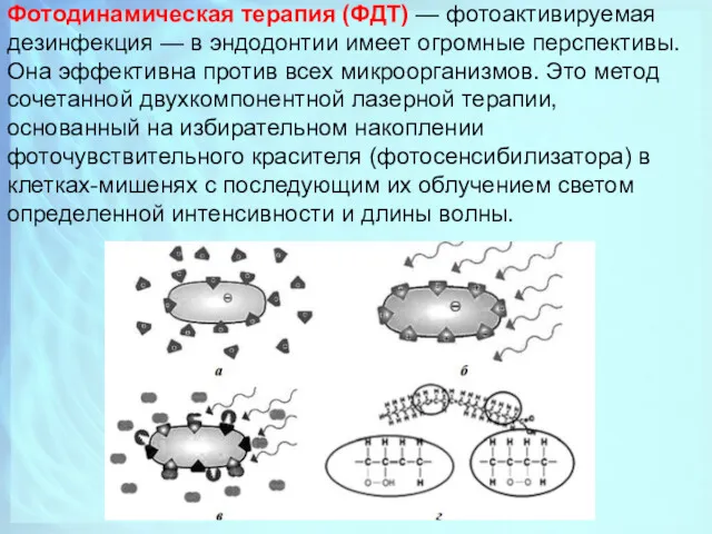 Фотодинамическая терапия (ФДТ) — фотоактивируемая дезинфекция — в эндодонтии имеет