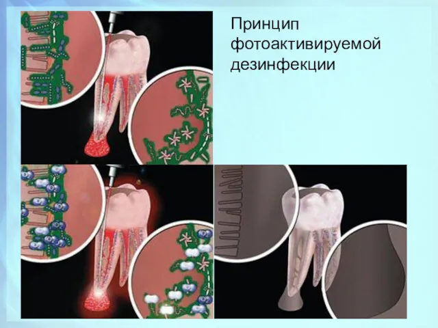 Принцип фотоактивируемой дезинфекции