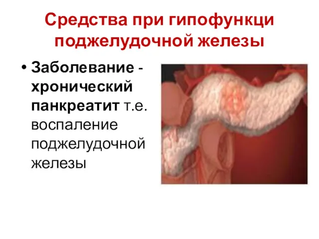 Средства при гипофункци поджелудочной железы Заболевание - хронический панкреатит т.е. воспаление поджелудочной железы