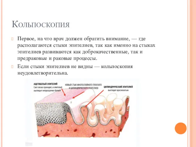 Кольпоскопия Первое, на что врач должен обратить внимание, — где