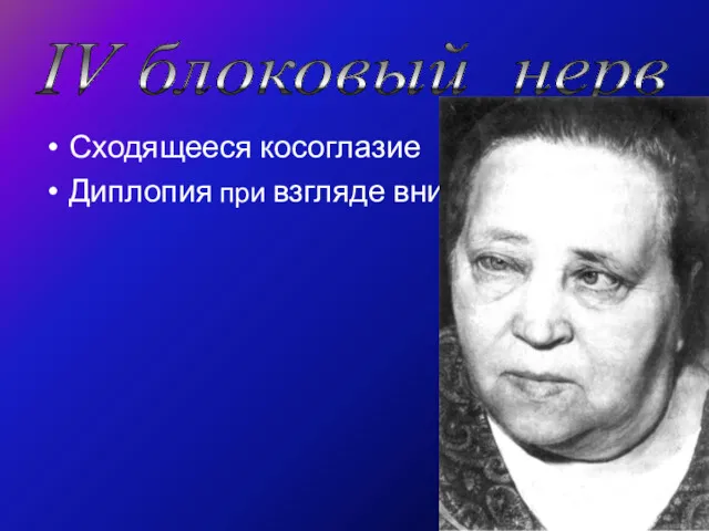 Сходящееся косоглазие Диплопия при взгляде вниз IV блоковый нерв