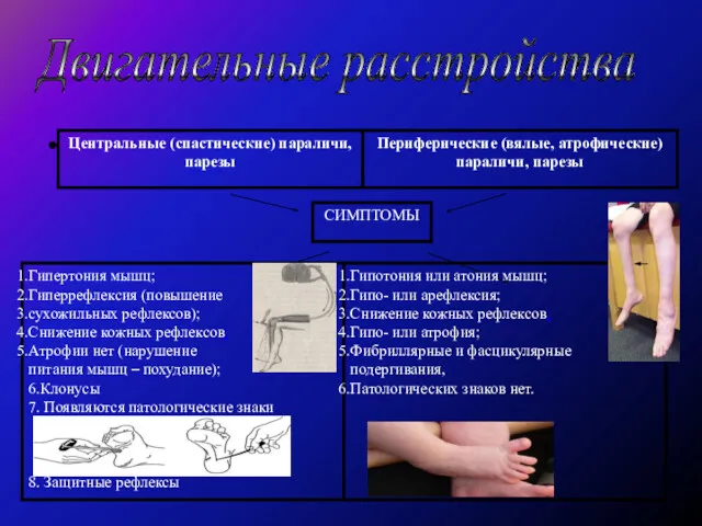 Двигательные расстройства
