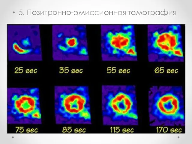 5. Позитронно-эмиссионная томография