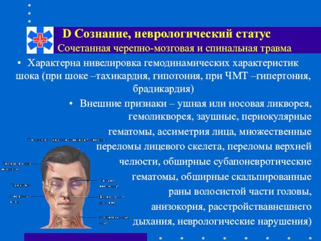 Сочетанная черепно-мозговая и спинальная травма Характерна нивелировка гемодинамических характеристик шока