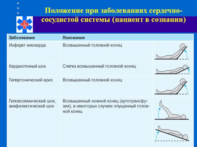 Положение при заболеваниях сердечно-сосудистой системы (пациент в сознании)