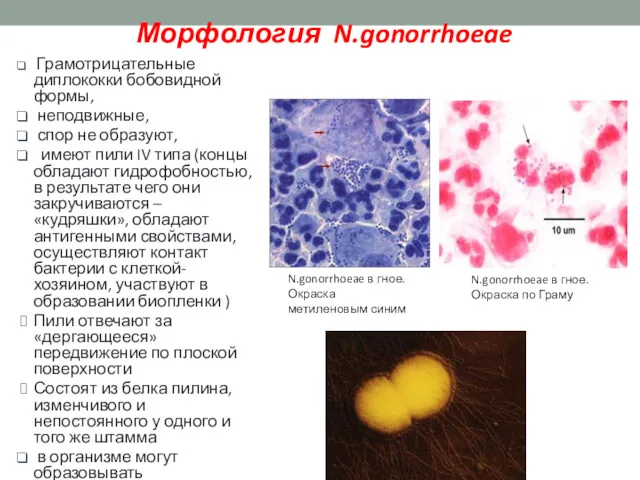 Морфология N.gonorrhoeae Грамотрицательные диплококки бобовидной формы, неподвижные, спор не образуют,