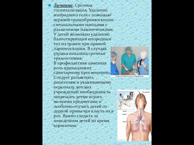 Лечение. Срочная госпитализация. Удаление инородного тела с помощью верхней трахеобронхоскопии