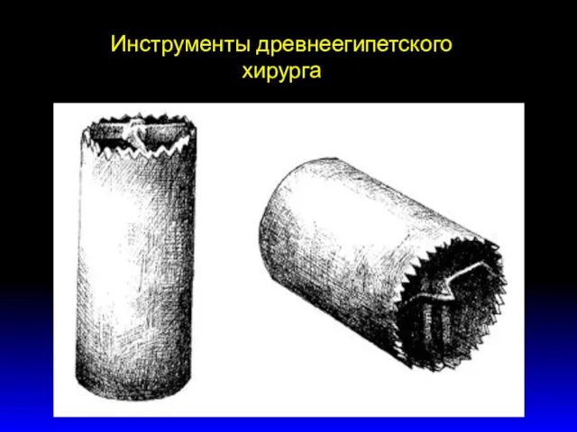 Инструменты древнеегипетского хирурга