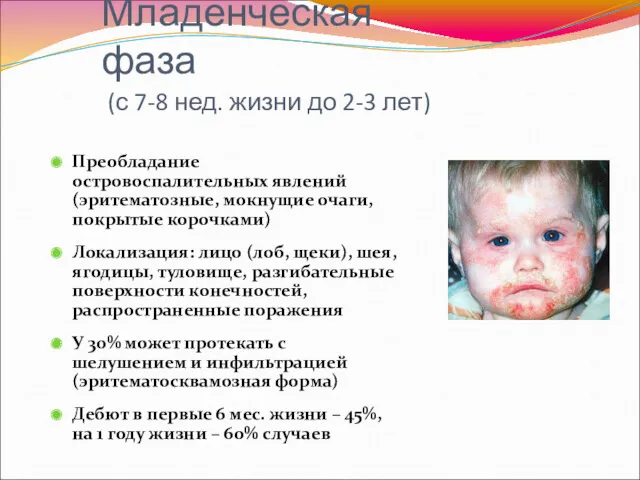 Младенческая фаза (с 7-8 нед. жизни до 2-3 лет) Преобладание