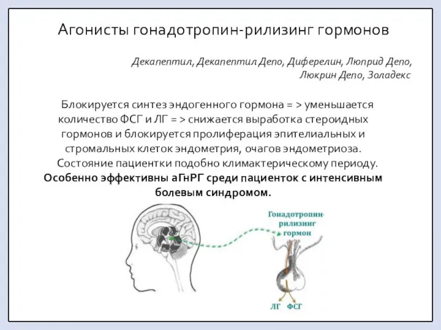 Агонисты гонадотропин-рилизинг гормонов Декапептил, Декапептил Депо, Диферелин, Люприд Депо, Люкрин