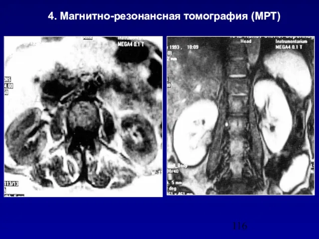 4. Магнитно-резонансная томография (МРТ)