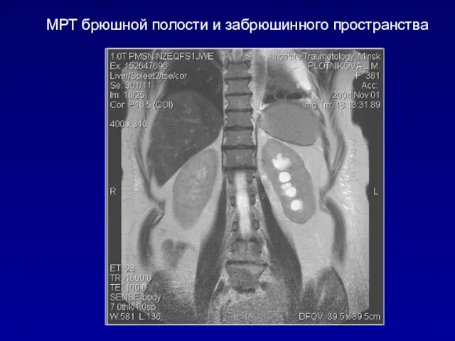 МРТ брюшной полости и забрюшинного пространства