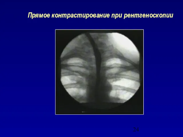 Прямое контрастирование при рентгеноскопии