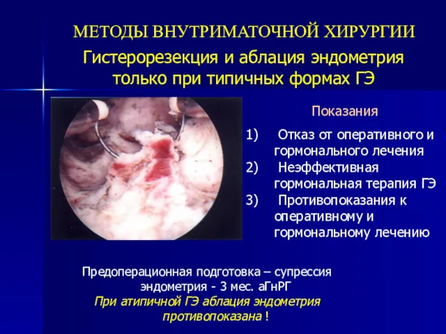 МЕТОДЫ ВНУТРИМАТОЧНОЙ ХИРУРГИИ Гистерорезекция и аблация эндометрия только при типичных