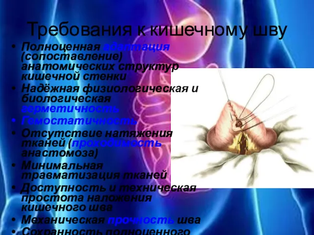 Требования к кишечному шву Полноценная адаптация (сопоставление) анатомических структур кишечной