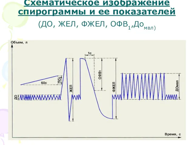 Схематическое изображение спирограммы и ее показателей (ДО, ЖЕЛ, ФЖЕЛ, ОФВ1,Домвл)