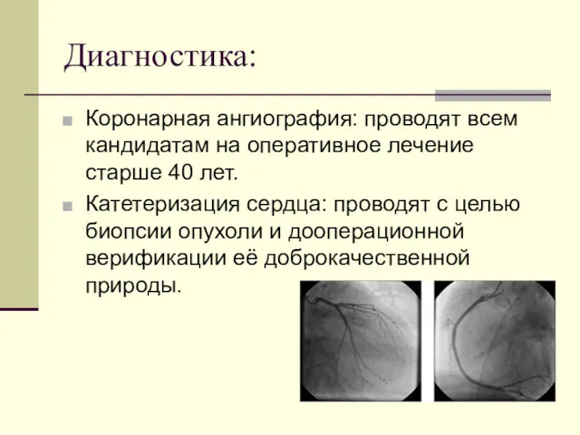 Диагностика: Коронарная ангиография: проводят всем кандидатам на оперативное лечение старше