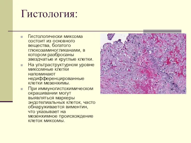 Гистология: Гистологически миксома состоит из основного вещества, богатого глюкозаминогликанами, в