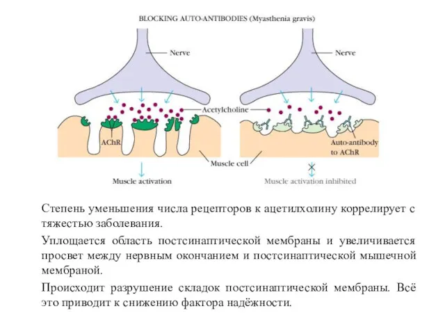 Степень уменьшения числа рецепторов к ацетилхолину коррелирует с тяжестью заболевания.