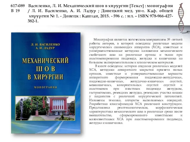 617-089 Василенко, Л. И. Механический шов в хирургии [Текст] :