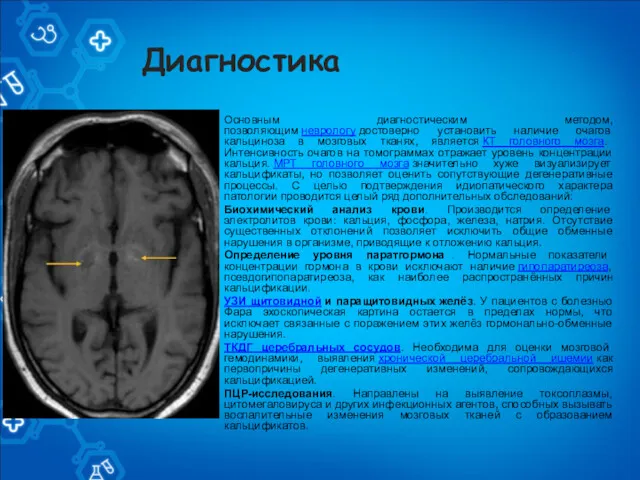 Диагностика Основным диагностическим методом, позволяющим неврологу достоверно установить наличие очагов