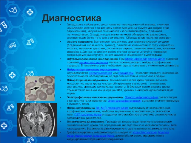 Диагностика Заподозрить нейроакантоцитоз позволяет наследственный анамнез, типичная клиническая картина с