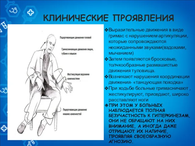 КЛИНИЧЕСКИЕ ПРОЯВЛЕНИЯ Выразительные движения в виде гримас с нарушением артикуляции,