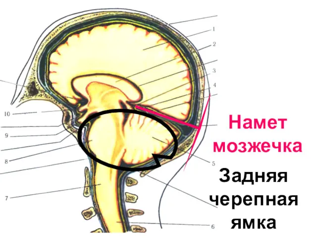 Намет мозжечка Задняя черепная ямка