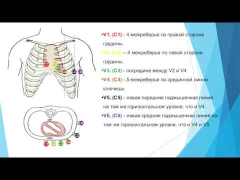 V1, (C1) - 4 межреберье по правой стороне грудины. V2,