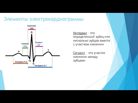 Элементы электрокардиограммы Интервал – это определенный зубец или несколько зубцов