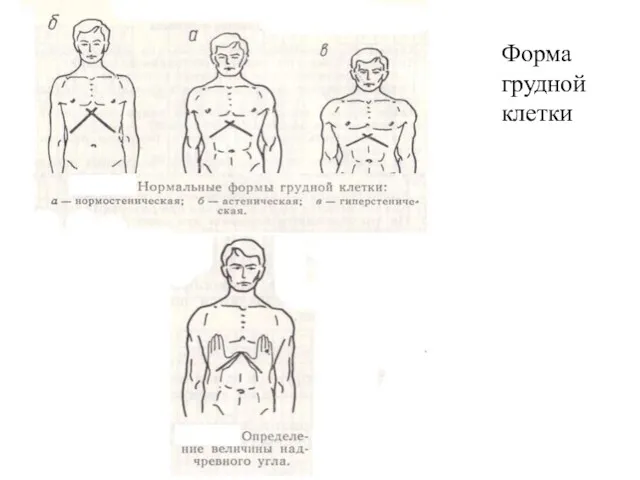 Форма грудной клетки