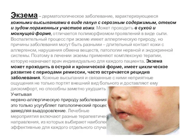 Экзема – дерматологическое заболевание, характеризующееся кожными высыпаниями в виде папул с серозным содержимым,
