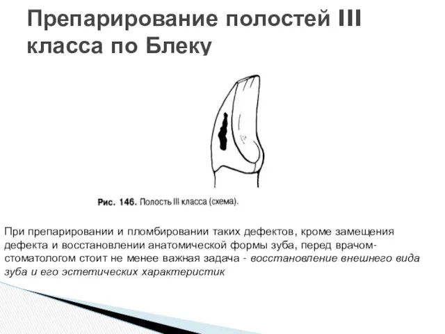 Препарирование полостей III класса по Блеку При препарировании и пломбировании