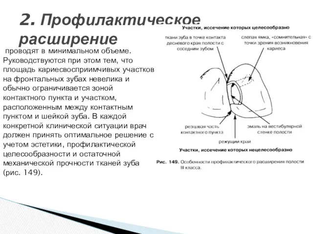 2. Профилактическое расширение проводят в минимальном объеме. Руководствуются при этом