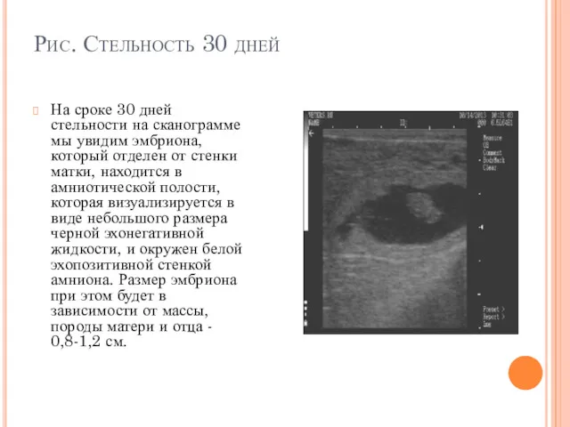 Рис. Стельность 30 дней На сроке 30 дней стельности на