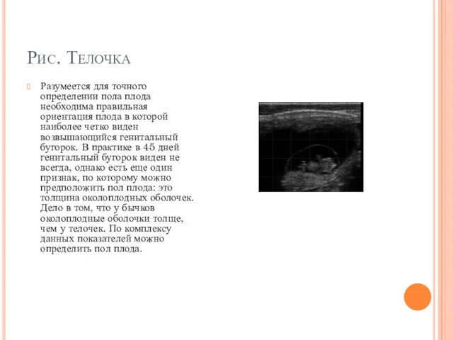 Рис. Телочка Разумеется для точного определении пола плода необходима правильная ориентация плода в