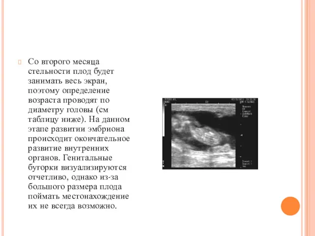 Со второго месяца стельности плод будет занимать весь экран, поэтому определение возраста проводят