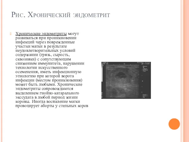 Рис. Хронический эндометрит Хронические эндометриты могут развиваться при проникновении инфекций через поврежденные участки