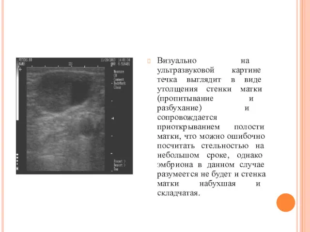 Визуально на ультразвуковой картине течка выглядит в виде утолщения стенки матки (пропитывание и