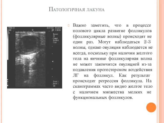 Патологичная лакуна Важно заметить, что в процессе полового цикла развитие фолликулов (фолликулярные волны)