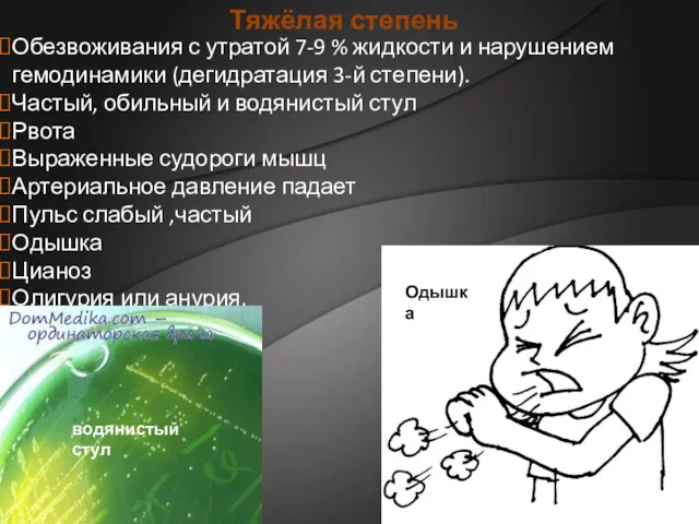 Обезвоживания с утратой 7-9 % жидкости и нарушением гемодинамики (дегидратация